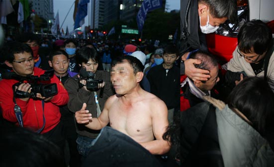 다수의 부상자가 속출했다. [사진-통일뉴스 김주영 기자]