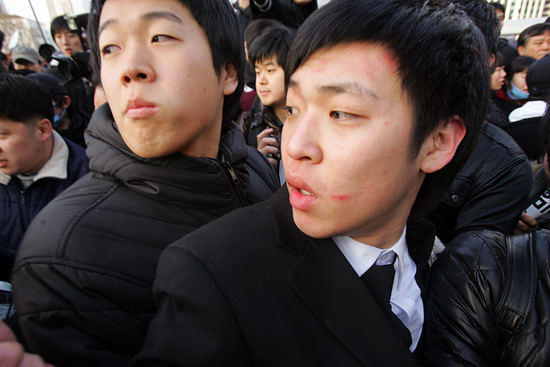 경찰의 폭력으로 인해 이마가 붓고, 얼굴에 상처가 난 이상흔씨.[사진-통일뉴스 조성봉 기자]