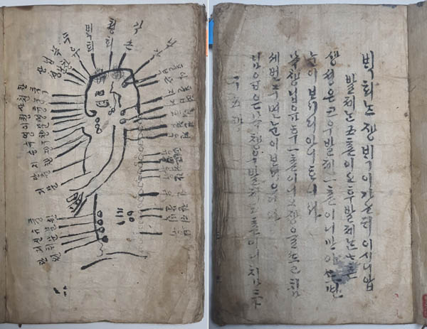 『한글 침구서』 앞-뒤 표지, 19C 초-중반, 필사본. [사진 제공 – 이양재]