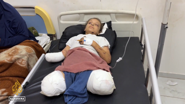이스라엘의 전면적 지상공격으로 부상당한 팔레스타인 어린이. [사진-알자지라 갈무리]
